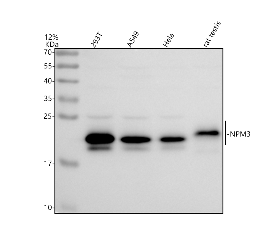 Western blot analysis of NPM3 using anti-NPM3 antibody (A10166)