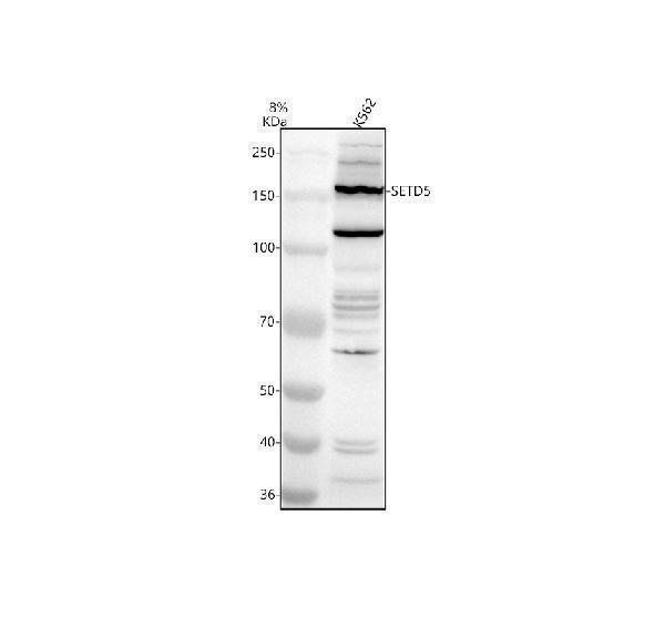 a10168 setd5 primary antibodies wb testing 1