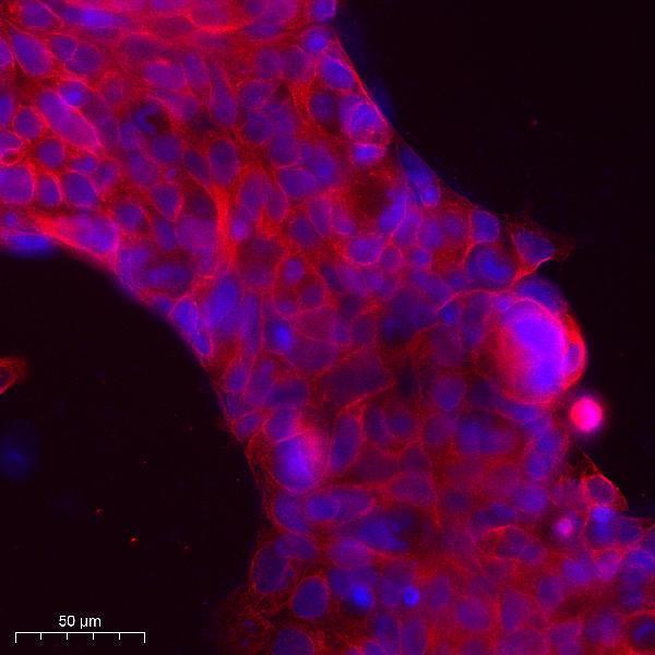 a10170 kcnk17 primary antibodies if testing 1