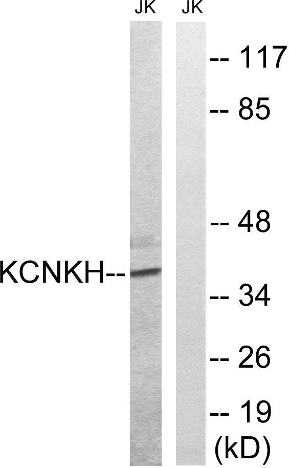 a10170 kcnk17 primary antibodies wb testing 2
