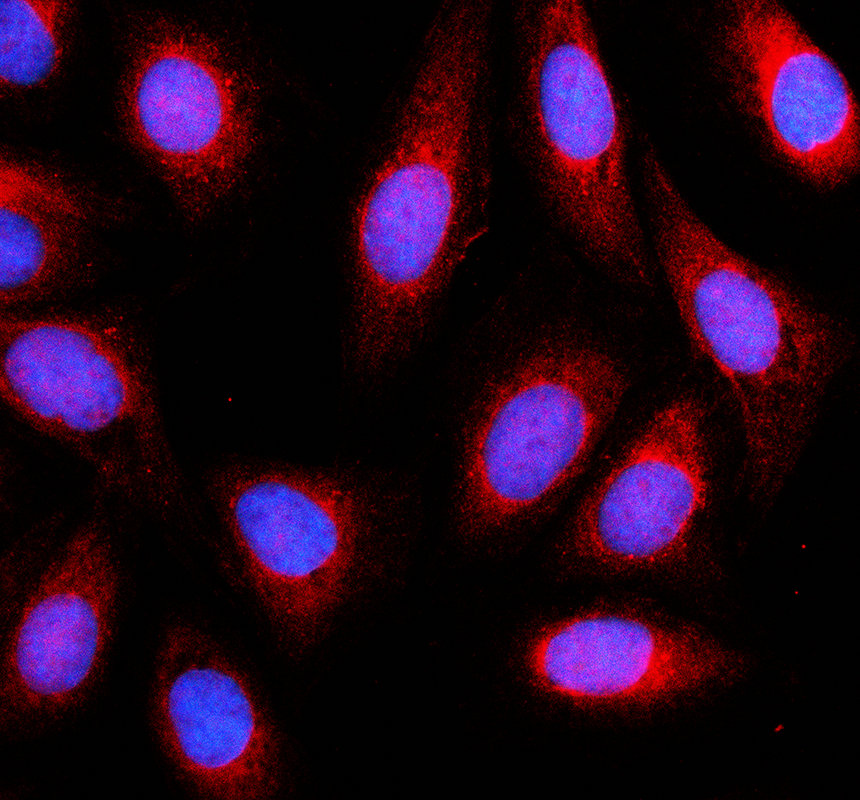 IF analysis of GADL1 using anti-GADL1 antibody (A10178-1)