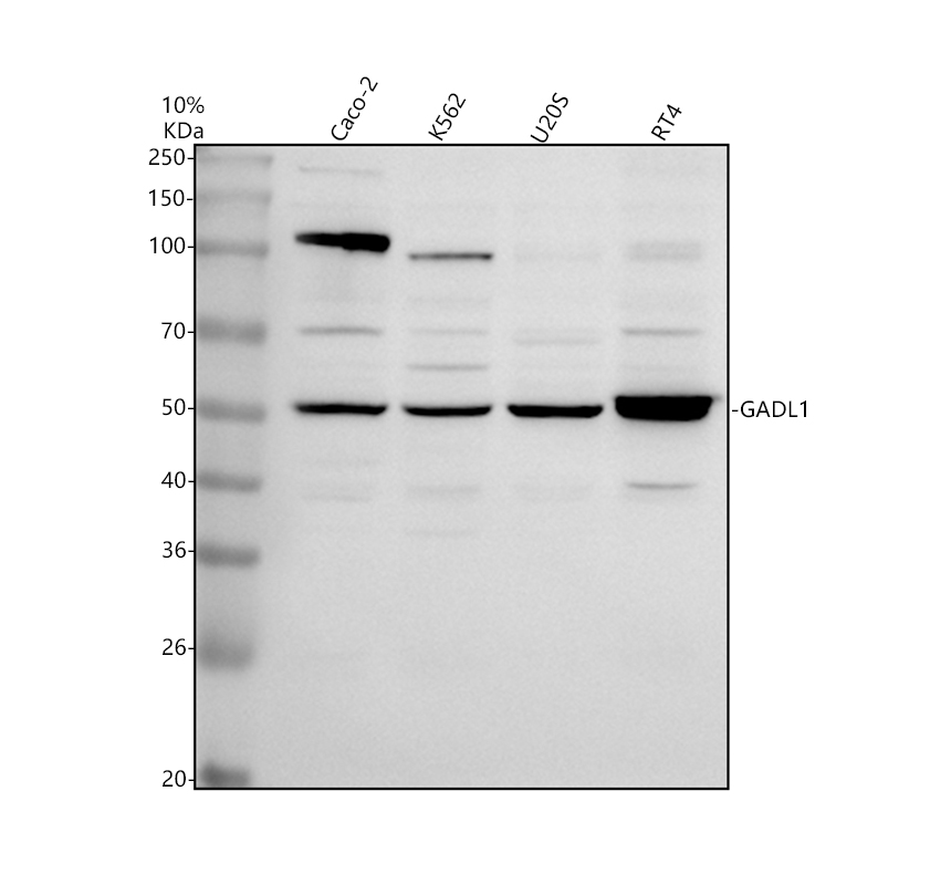 Western blot analysis of GADL1 using anti-GADL1 antibody (A10178-1)