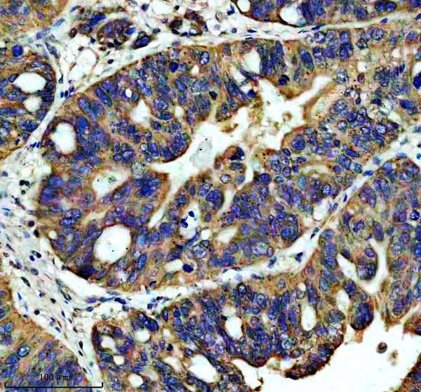 IHC analysis of ISCA2 using anti-ISCA2 antibody (A10181-1)