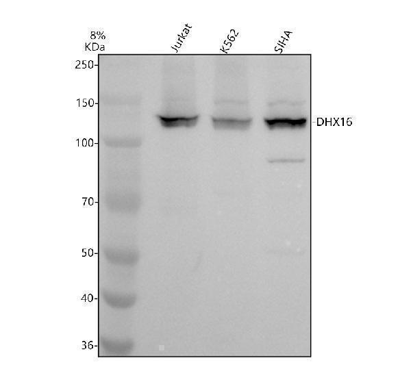 Western blot analysis of DHX16 using anti-DHX16 antibody (A10183-1)