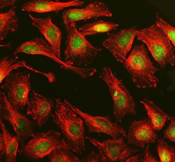  IF analysis of MPLKIP using anti-MPLKIP antibody (A10184-1) and anti-Beta Tubulin antibody (M01857-3)