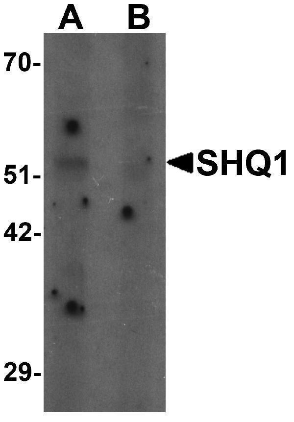 a10185 shq1 primary antibodies wb testing 1