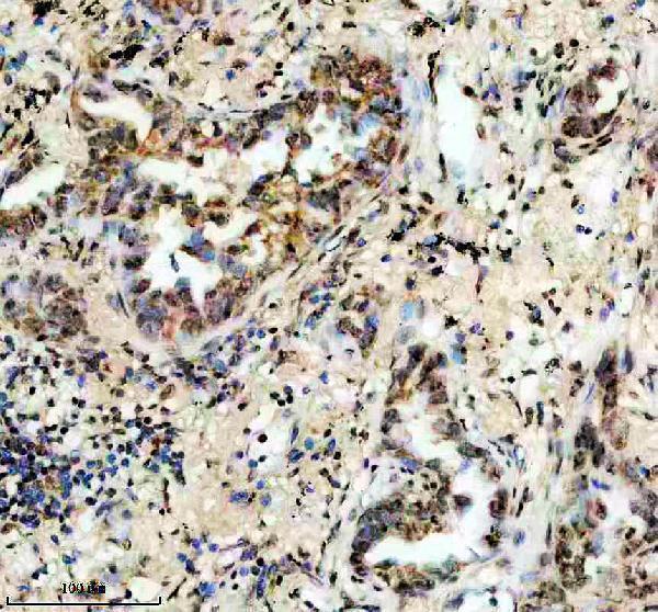 IHC analysis of ERGIC2 using anti-ERGIC2 antibody (A10196-1)