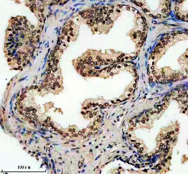 IHC analysis of ERGIC2 using anti-ERGIC2 antibody (A10196-1)