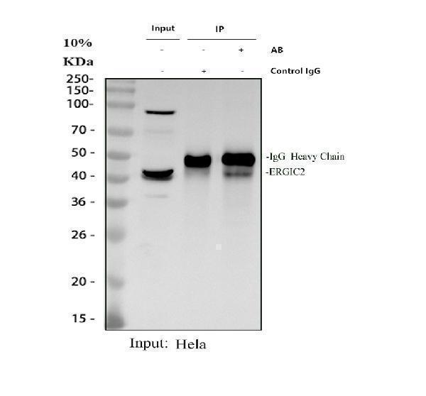 a10196 1 ergic2 primary antibodies ip testing 1