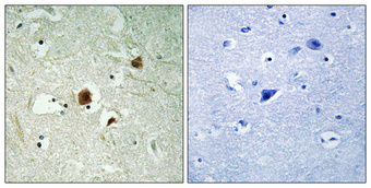 Immunohistochemistry validation of ARHGAP22 using Anti-ARHGAP22 Antibody (A10197)