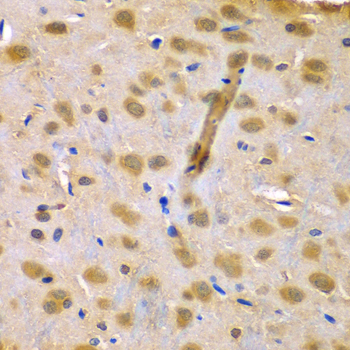 a10201 rufy1 primary antiboties ihc testing 2