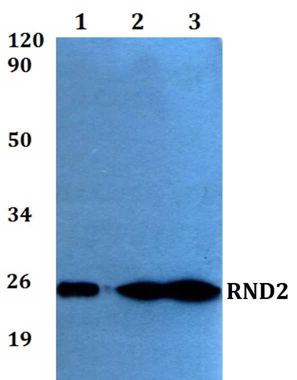 Western blot (WB) analysis of RND2 polyclonal antibody at 1:500 dilution
Lane1:HEK293T whole cell lysate
Lane2:sp2/0 whole cell lysate 
Lane3:PC12 whole cell lysate 