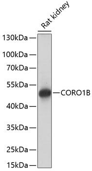 Western blot analysis of extracts of rat kidney, using CORO1B antibody  at 1:1000 dilution