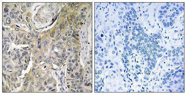a10214 rhobtb3 primary antibodies ihc testing 1