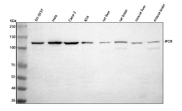 Figure 1. Western blot analysis of IPO9 using anti-IPO9 antibody (A10216-2). Electrophoresis was performed on a 5-20% SDS-PAGE gel at 70V (Stacking gel) / 90V (Resolving gel) for 2-3 hours. The sample well of each lane was loaded with 30 ug of sample under reducing conditions. Lane 1: human SH-SY5Y whole cell lysates, Lane 2: human Hela whole cell lysates, Lane 3: human Caco-2 whole cell lysates, Lane 4: human RT4 whole cell lysates, Lane 5: rat liver tissue lysates, Lane 6: rat brain tissue lysates, Lane 7: mouse liver tissue lysates, Lane 8: mouse brain tissue lysates. After electrophoresis, proteins were transferred to a nitrocellulose membrane at 150 mA for 50-90 minutes. Blocked the membrane with 5% non-fat milk/TBS for 1.5 hour at RT. The membrane was incubated with rabbit anti-IPO9 antigen affinity purified polyclonal antibody (Catalog # A10216-2) at 0.5 microg/mL overnight at 4°C, then washed with TBS-0.1%Tween 3 times with 5 minutes each and probed with a goat anti-rabbit IgG-HRP secondary antibody at a dilution of 1:5000 for 1.5 hour at RT. The signal is developed using an Enhanced Chemiluminescent detection (ECL) kit (Catalog # EK1002) with Tanon 5200 system. A specific band was detected for IPO9 at approximately 120 kDa. The expected band size for IPO9 is at 120 kDa.