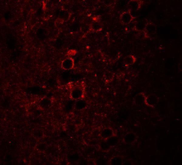 Immunofluorescence of CCDC55 in mouse brain cells with CCDC55 antibody at 20 μg/mL