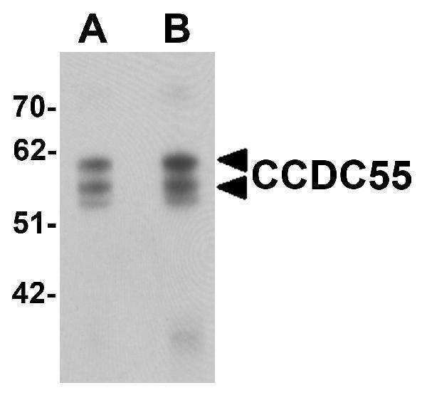 Western blot analysis of CCDC55 in human brain tissue lysate with CCDC55 antibody at (A) 0