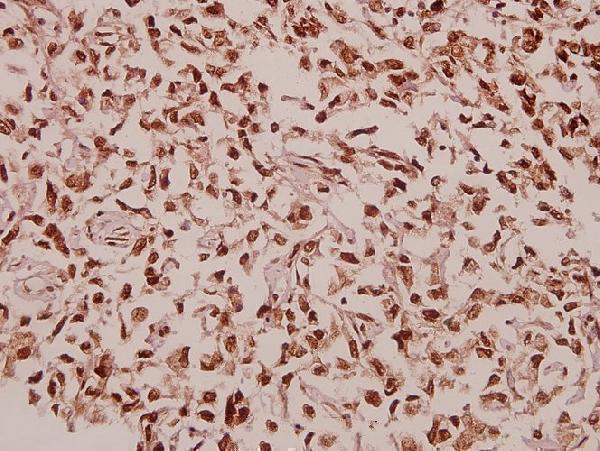 a10219s39 rpl39 primary antiboties ihc testing 2