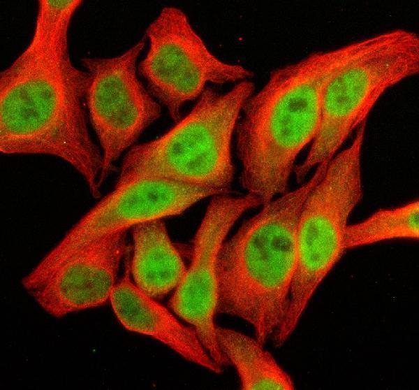 IF analysis of SFMBT2 using anti-SFMBT2 antibody (A10221) and anti-Beta Tubulin antibody (M01857-3)