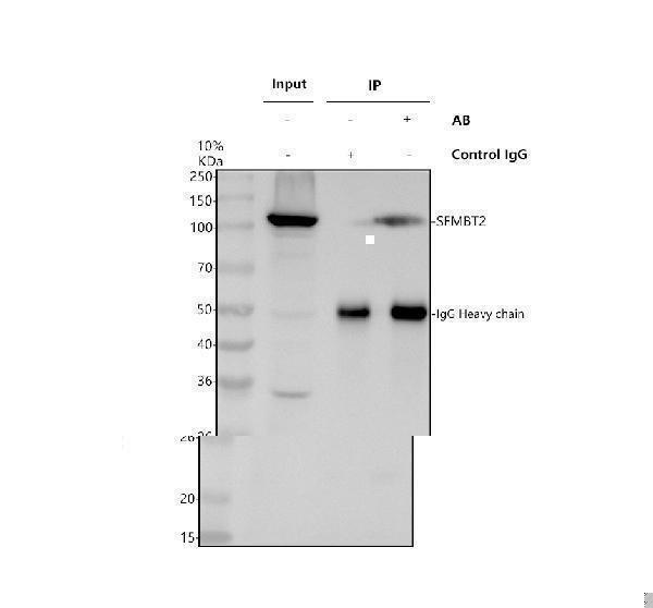 Immunoprecipitating SFMBT2 in Jurkat whole cell lysate