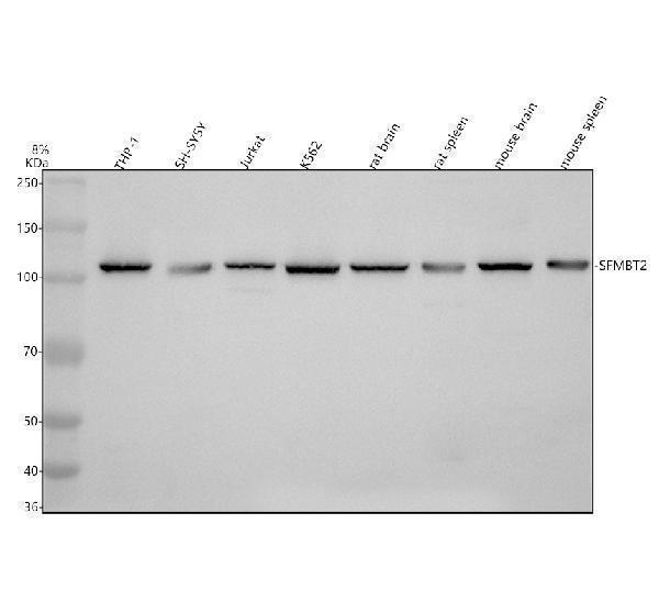 Western blot analysis of SFMBT2 using anti-SFMBT2 antibody (A10221)