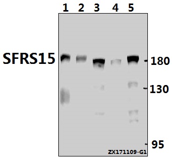 Western blot (WB) analysis of SFRS15 (V641) pAb at 1:1000 dilution
Lane1:C6 whole cell lysate(40ug)
Lane2:CT26 whole cell lysate(40ug)
Lane3:HCT116 whole cell lysate(40ug)
Lane4:SGC7901 whole cell lysate(40ug)
Lane5:HEK293T whole cell lysate(20ug)