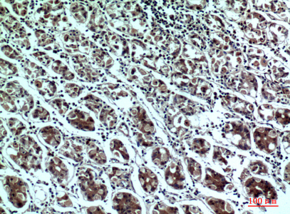 a10225 ppp1r15b primary antibodies ihc testing 1