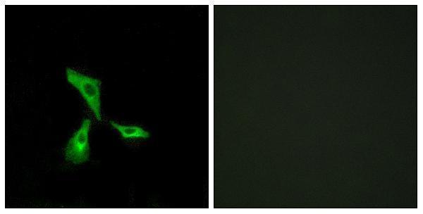 a10226 gpr101 primary antibodies if testing 1