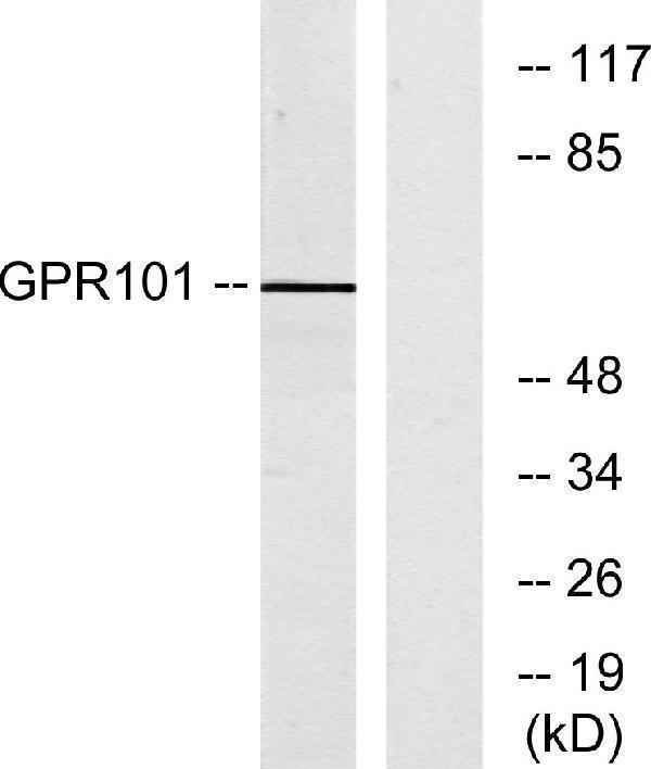 a10226 gpr101 primary antibodies wb testing 3