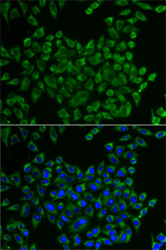 Immunofluorescence analysis of U2OS cells using MRPS30 antibody 