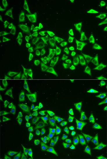 Immunoprecipitation analysis of 200ug extracts of HepG2 cells using 1ug MRPS30 antibody 