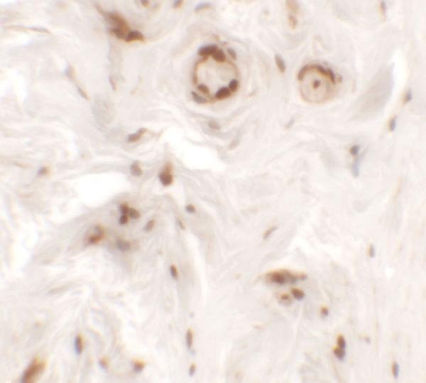 Immunohistochemistry of UPK1B in human bladder tissue with UPK1B antibody at 5 μg/mL