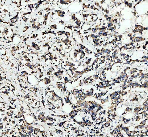 IHC analysis of NDUFB7 using anti-NDUFB7 antibody (A10231-1)