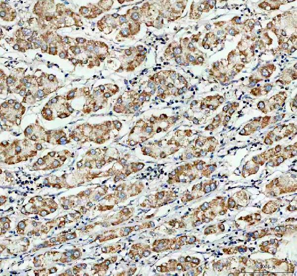 IHC analysis of NDUFB7 using anti-NDUFB7 antibody (A10231-1)