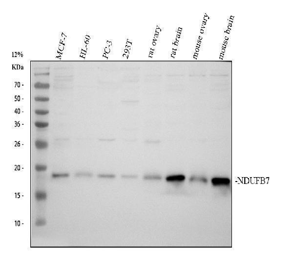 Western blot analysis of NDUFB7 using anti-NDUFB7 antibody (A10231-1)