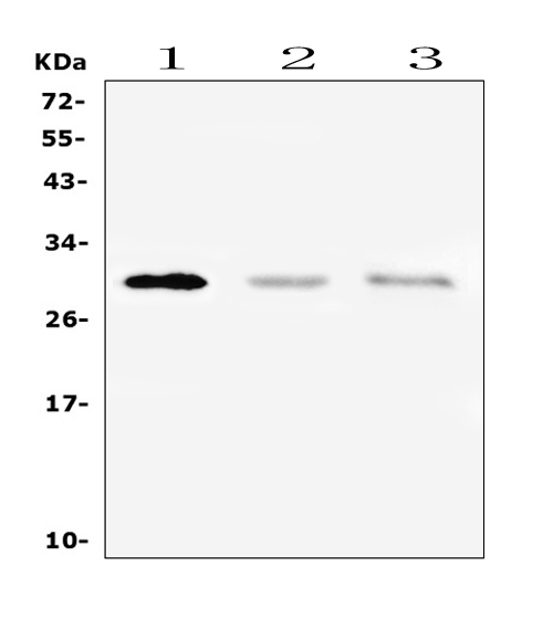  Western blot analysis of PTCRA using anti-PTCRA antibody (A10240-1)