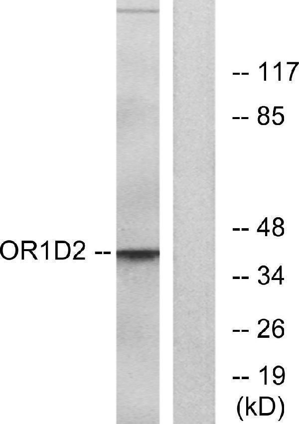 Western blot analysis of lysates from Jurkat cells, using OR1D2 Antibody