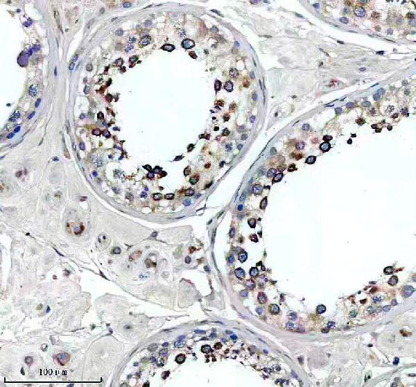 a10242 1 slc2a11 primary antibodies ihc testing 1