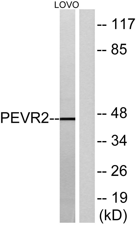 Western blot analysis of lysates from LOVO cells, using PEVR2 Antibody