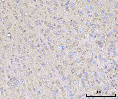 Figure 2. IHC analysis of RPH3A using anti-RPH3A antibody (A10247-2). RPH3A was detected in a paraffin-embedded section of mouse brain tissue. Heat mediated antigen retrieval was performed in EDTA buffer (pH 8.0, epitope retrieval solution). The tissue section was blocked with 10% goat serum. The tissue section was then incubated with 2 microg/ml rabbit anti-RPH3A Antibody (A10247-2) overnight at 4°C. Peroxidase Conjugated Goat Anti-rabbit IgG was used as secondary antibody and incubated for 30 minutes at 37°C. The tissue section was developed using HRP Conjugated Rabbit IgG Super Vision Assay Kit (Catalog # SV0002) with DAB as the chromogen.