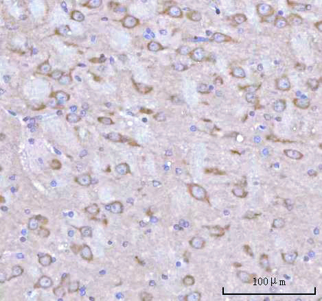 Figure 3. IHC analysis of RPH3A using anti-RPH3A antibody (A10247-2). RPH3A was detected in a paraffin-embedded section of rat brain tissue. Heat mediated antigen retrieval was performed in EDTA buffer (pH 8.0, epitope retrieval solution). The tissue section was blocked with 10% goat serum. The tissue section was then incubated with 2 microg/ml rabbit anti-RPH3A Antibody (A10247-2) overnight at 4°C. Peroxidase Conjugated Goat Anti-rabbit IgG was used as secondary antibody and incubated for 30 minutes at 37°C. The tissue section was developed using HRP Conjugated Rabbit IgG Super Vision Assay Kit (Catalog # SV0002) with DAB as the chromogen.