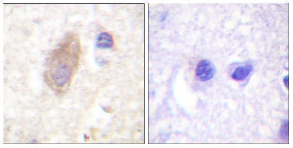 Immunohistochemistry analysis of paraffin-embedded human brain tissue, using Rabphilin 3A Antibody