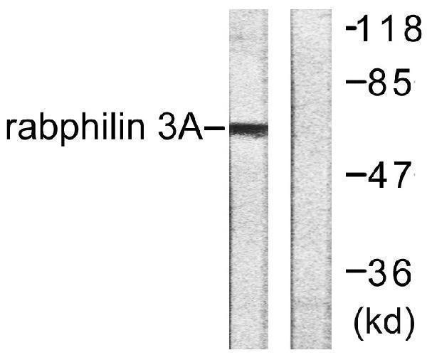 Western blot analysis of lysates from HeLa cells, treated with TNF-a 20ng/ml 2