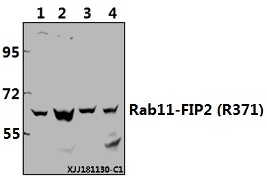 Western blot (WB) analysis of Rab11-FIP2 (R371) polyclonal antibody at 1:500 dilution
Lane1:A549 whole cell lysate(40ug)
Lane2:HCT116 whole cell lysate(40ug)
Lane3:3T3-L1 whole cell lysate(40ug)
Lane4:PC12 whole cell lysate(40ug)
