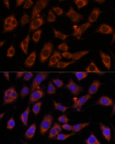 Immunofluorescence analysis of L929 cells using GFPT2 antibody  at dilution of 1:100