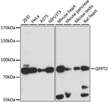 Western blot analysis of extracts of various cell lines, using GFPT2 antibody  at 1:1000 dilution