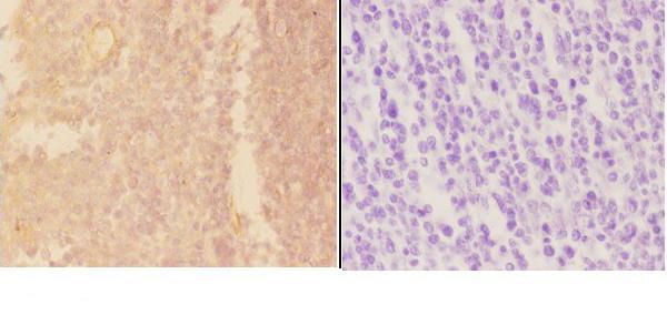 a10260 adamdec1 primary antiboties ihc testing 2