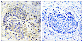 a10261 1 acot2 primary antibodyes ihc testing 2