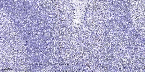a10267 1 st18 primary antibodies ihc testing 1