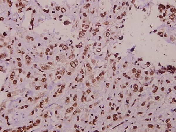 a10267 st18 primary antiboties ihc testing 2